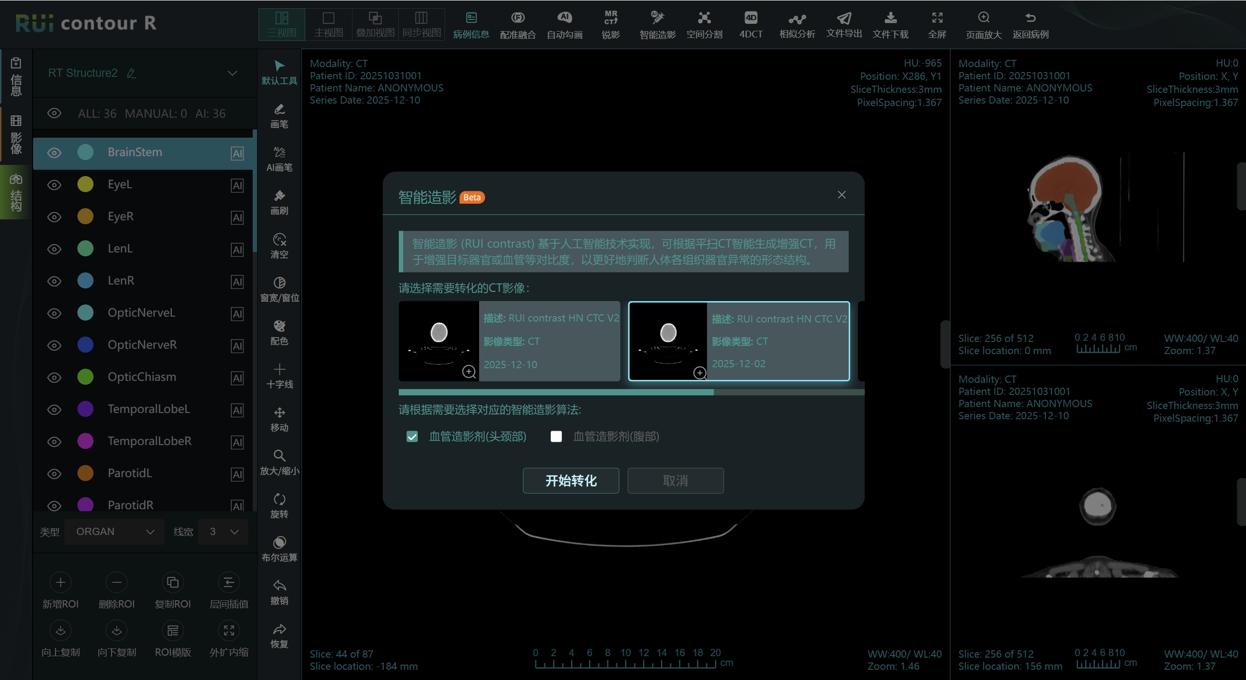 RUI Contour M 智能造影功能界面